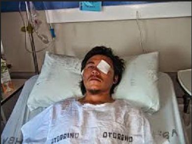 Presentan querella criminal en contra de Carabineros por disparar en el rostro a comunero Mapuche