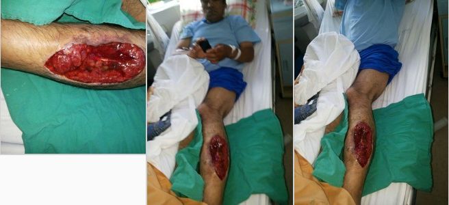 Impactante imagen de comunero mapuche baleado por Carabineros de Chile
