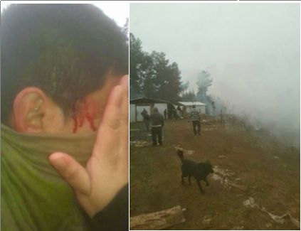 JOVEN MAPUCHE HERIDO Y ASALTO DE VIVIENDA DE AUTORIDAD MAPUCHE 