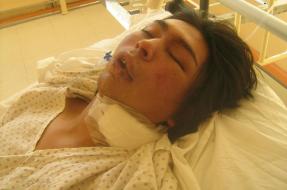 La Araucanía: Defensora Regional afirma que mapuche detenido estaba sedado y heridas “no eran leves”