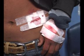 Revelan imágenes: Niños mapuche resultaron heridos con perdigones en Collipulli