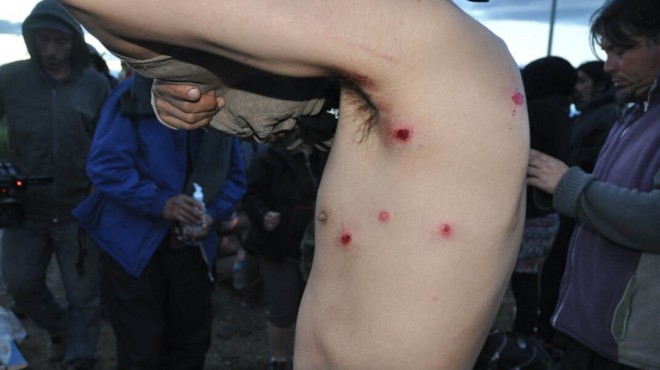 La Iglesia y Amnistía repudian represión a mapuches en Chubut