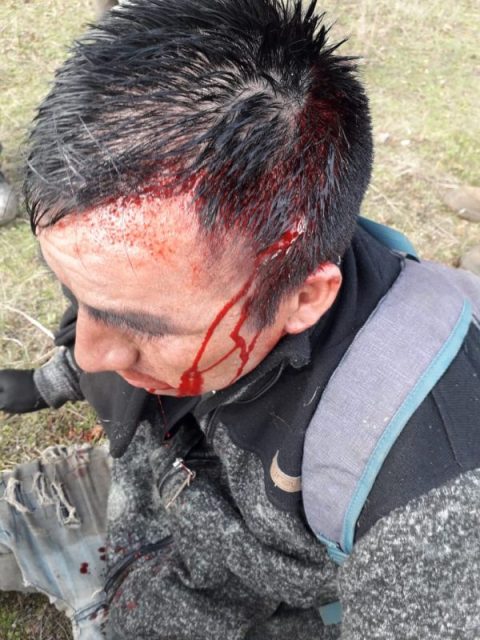 Comunero Mapuche baleado en la cabeza por Carabineros de Chile