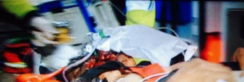 Guido Curihuentro Millaleo, comunero mapuche herido a bala en riesgo vital 
